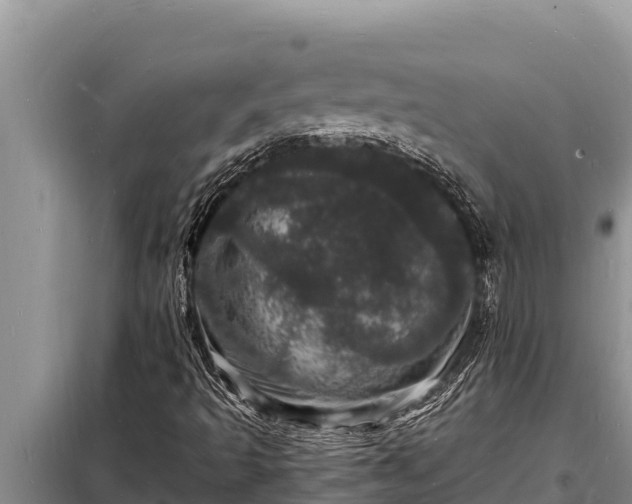 X0000098181493200805011024