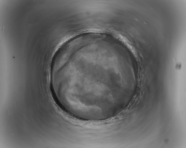 X0000098180011200805081035