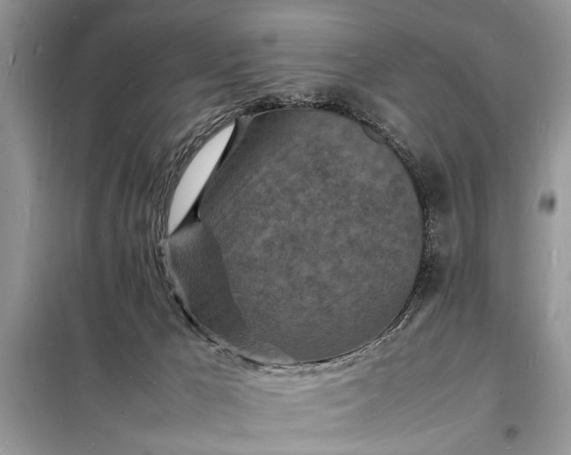 X0000098180029200805081035