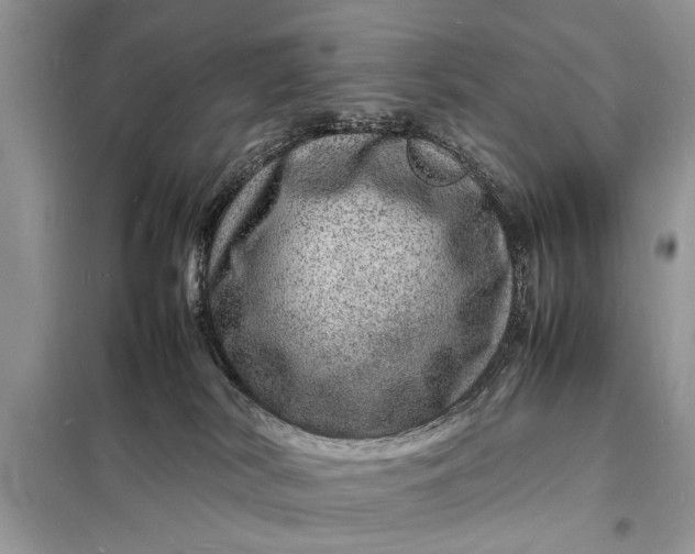 X0000098180038200805081034