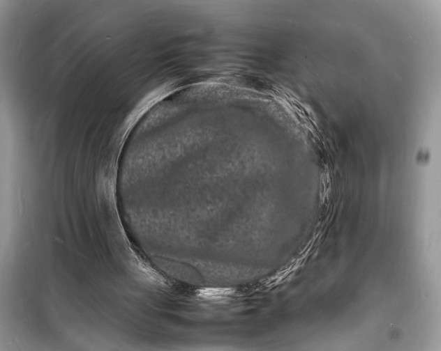 X0000098180051200805081033