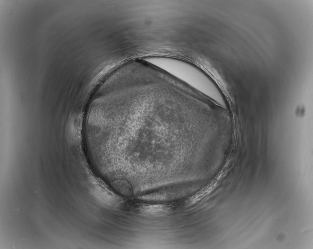 X0000098180058200805081034