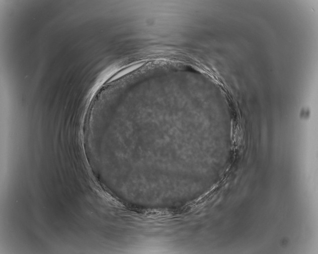 X0000098180099200805081033