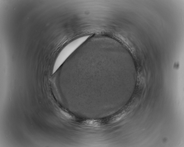 X0000098180117200805081033