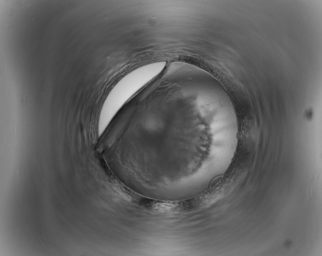 X0000098180139200805081033