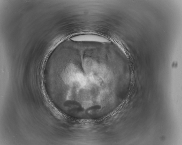 X0000098180145200805081032