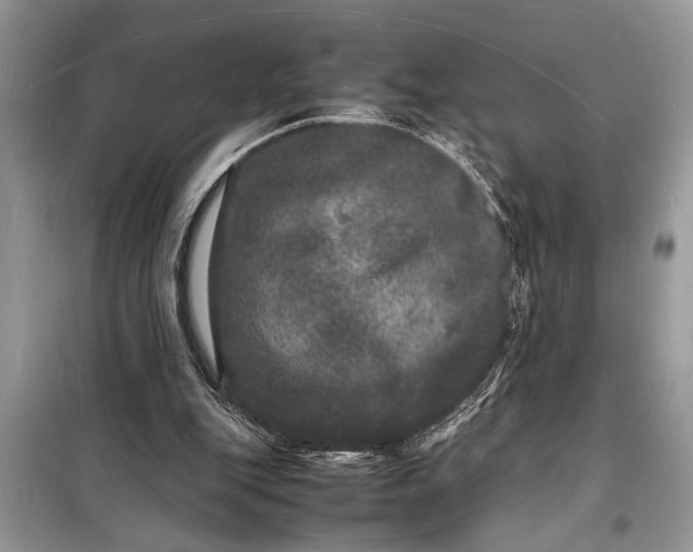 X0000098180151200805081032