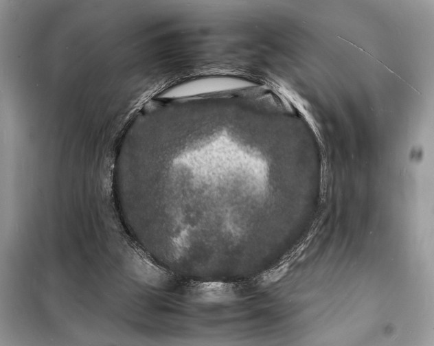 X0000098180153200805081032