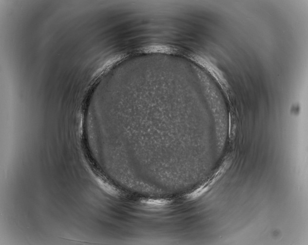 X0000098180157200805081032