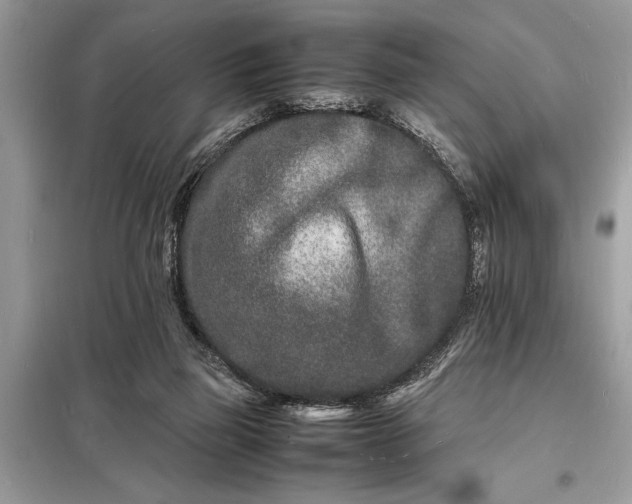 X0000098180165200805081032