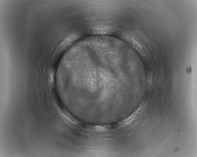 X0000098180166200805081032