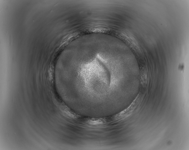 X0000098180175200805081032