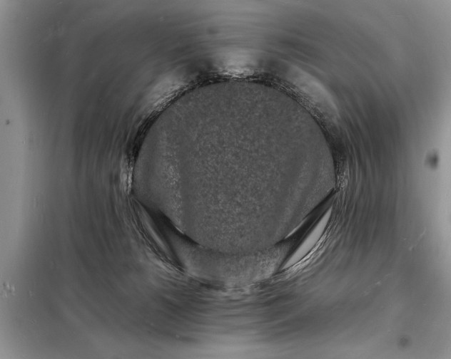 X0000098180180200805081032