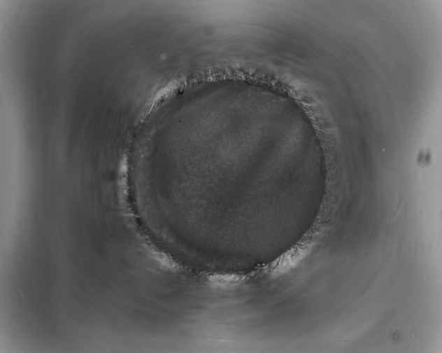 X0000098180192200805081033