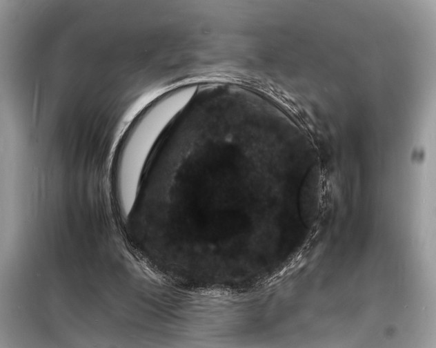 X0000098180200200805081032