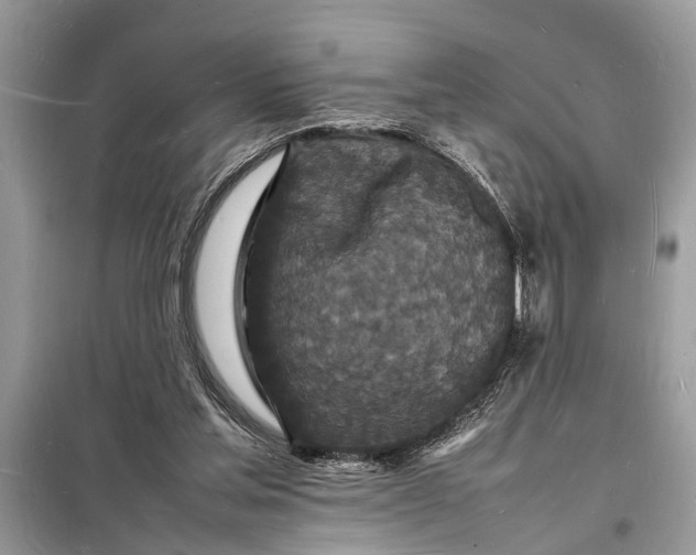 X0000098180205200805081032