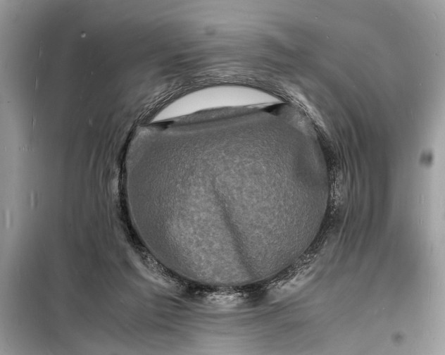 X0000098180213200805081032