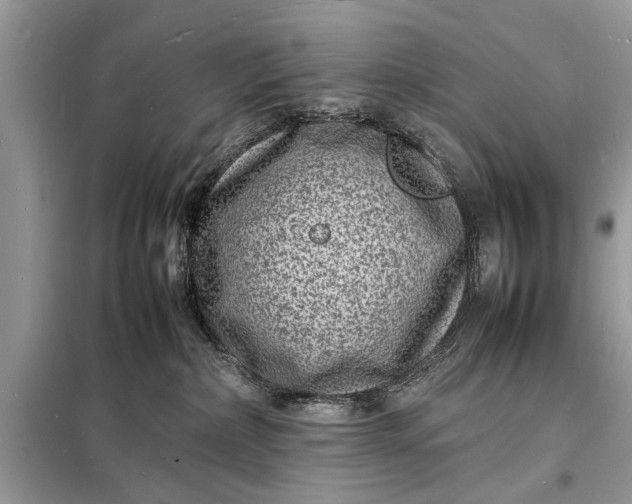 X0000098180236200805081031