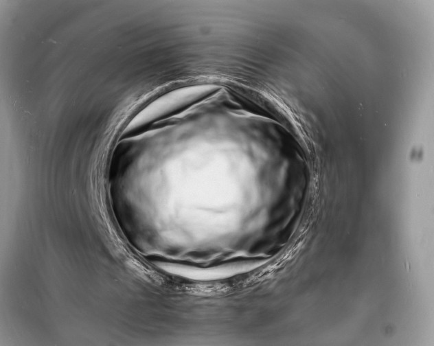 X0000098180241200805081030