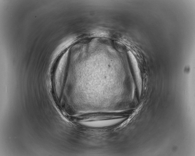 X0000098180245200805081030