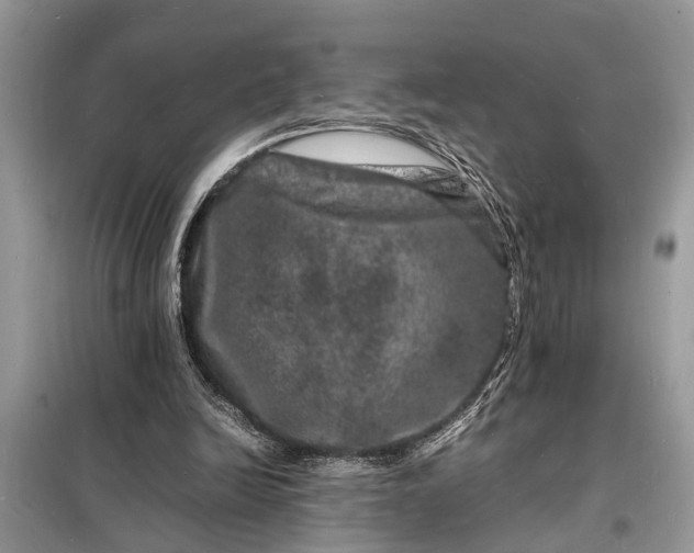 X0000098180246200805081030