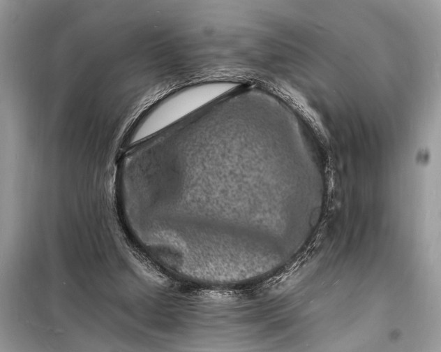 X0000098180250200805081030