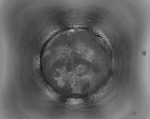 X0000098180251200805081030