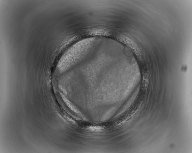 X0000098180255200805081030