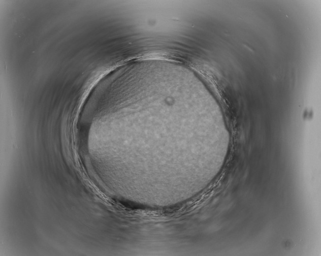 X0000098180289200805081030