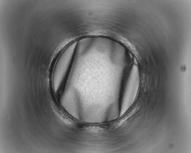 X0000098180298200805081030