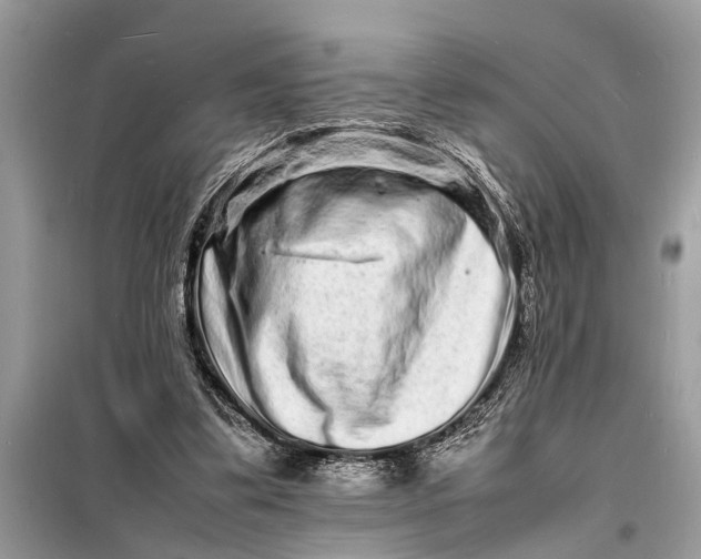 X0000098180299200805081030