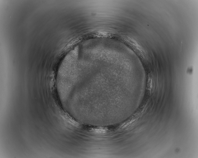 X0000098180318200805081030