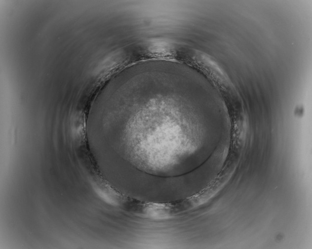 X0000098180320200805081030