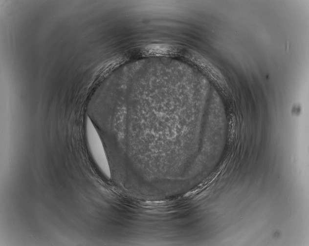 X0000098180361200805081029