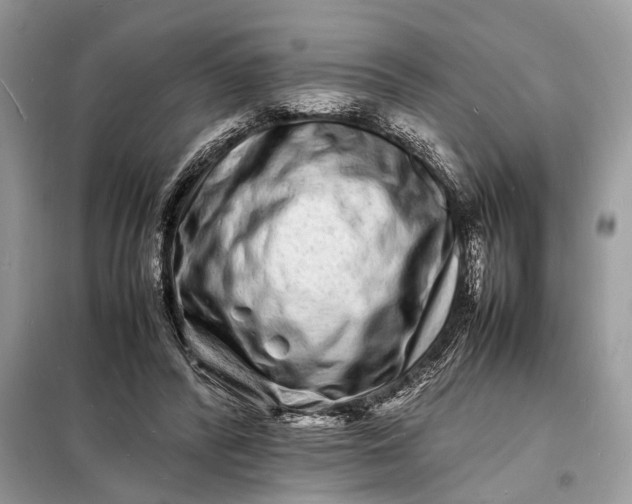 X0000098180400200805081028