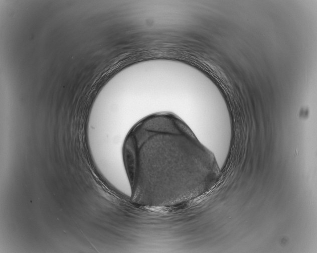 X0000098180409200805081028