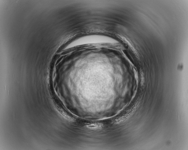 X0000098180447200805081028