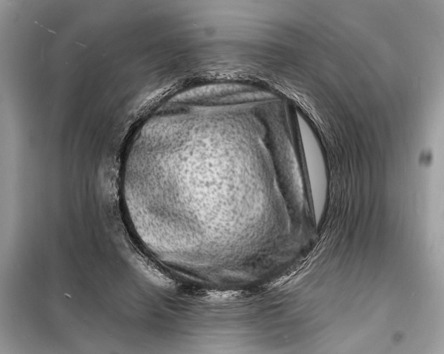 X0000098180450200805081028