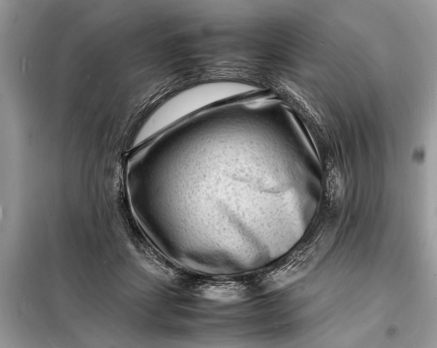 X0000098180459200805081028