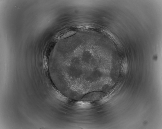 X0000098180477200805081028