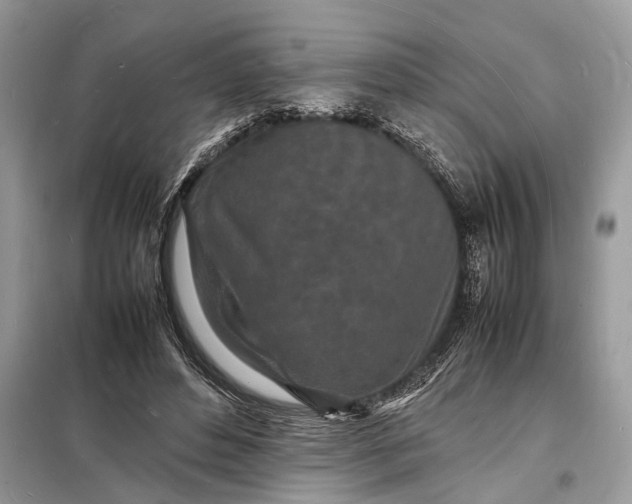 X0000098180496200805081027