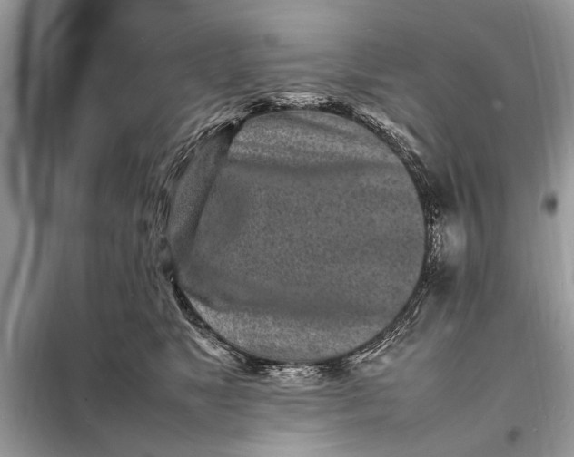 X0000098180517200805081027