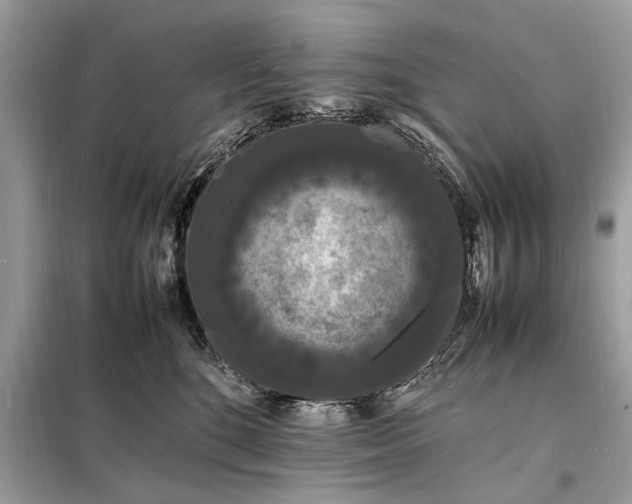 X0000098180520200805081027