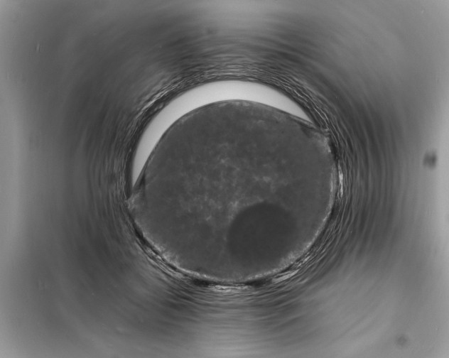 X0000098180556200805081026