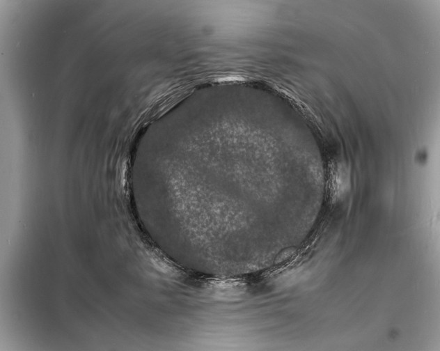 X0000098180619200805081025