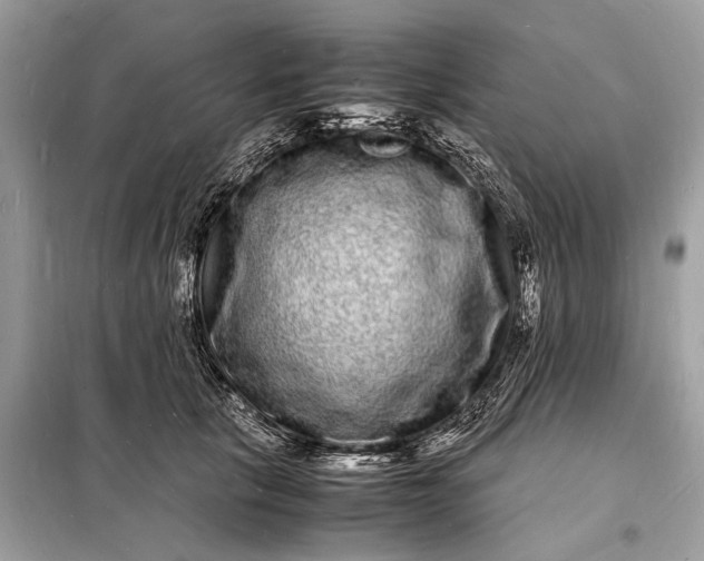 X0000098180657200805081025