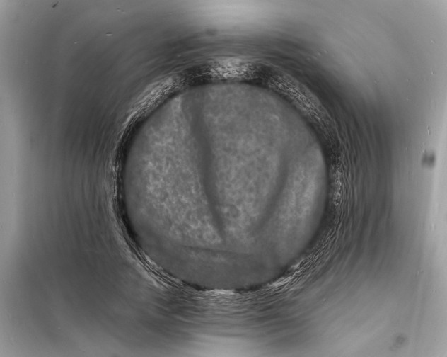 X0000098180738200805081023