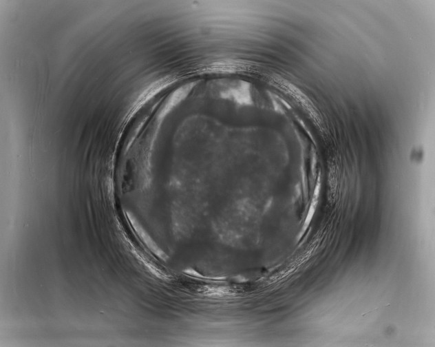 X0000098180794200805081023