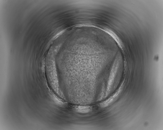 X0000098180857200805081022