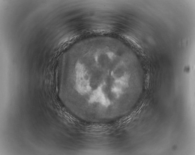 X0000098180917200805081021